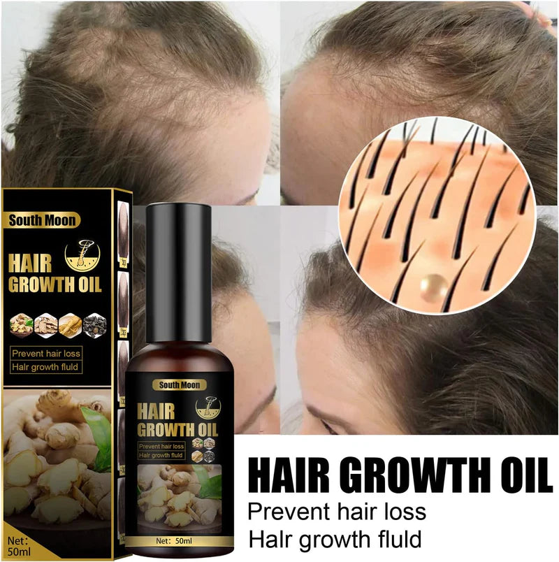 🌿 Ginger Hair Growth Oil | Natural Hair Growth & Anti Hair Loss Oil | South Moon 50ml.