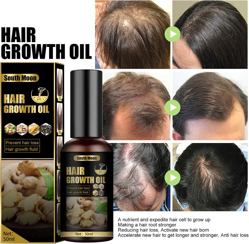 🌿 Ginger Hair Growth Oil | Natural Hair Growth & Anti Hair Loss Oil | South Moon 50ml.