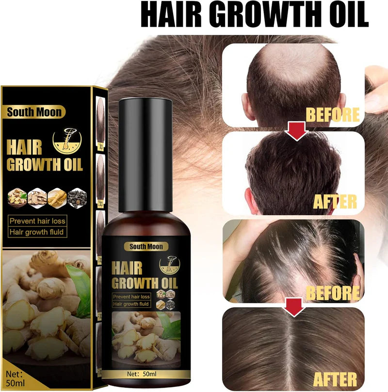 🌿 Ginger Hair Growth Oil | Natural Hair Growth & Anti Hair Loss Oil | South Moon 50ml.