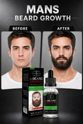 🧔 Natural Men Beard Oil | Beard Growth & Softening Oil | Premium Beard Care for Men.